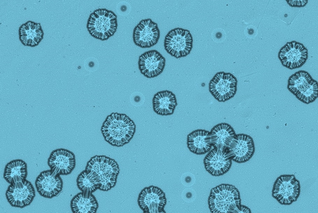 Image holographique sans lentille de Escherichia coli et de Staphylococcus epidermidis.